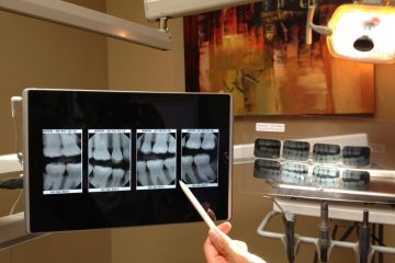 analog-dental-xray-langford (816 x 612)