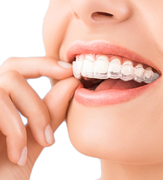 An Invisalign patient at Parkway Dental holds her barely visible clear aligners for teeth straightening